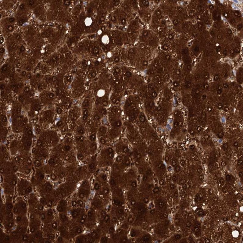 Staining of human liver shows strong cytoplasmic-nucleus positivity in hepatocytes.