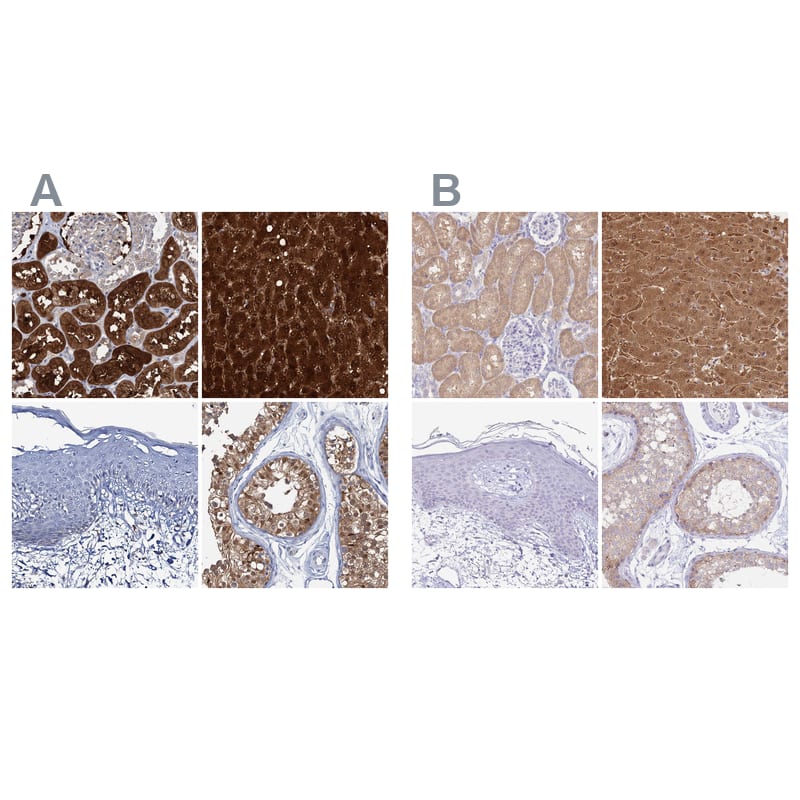 <b>Orthogonal Strategies Validation. </b>Staining of human kidney, liver, skin and testis HPA041370 (A) shows similar protein distribution across tissues to independent antibody HPA044093 (B).