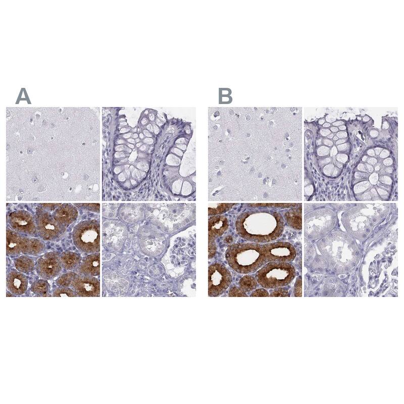 <b>Independent Antibodies Validation. </b>Staining of human cerebral cortex, colon, duodenum and kidney using NBP2-48738 (A) shows similar protein distribution across tissues to independent antibody NBP1-91000 (B).