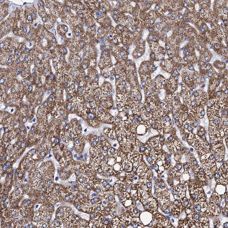 Staining of human liver shows strong cytoplasmic granular positivity in hepatocytes.