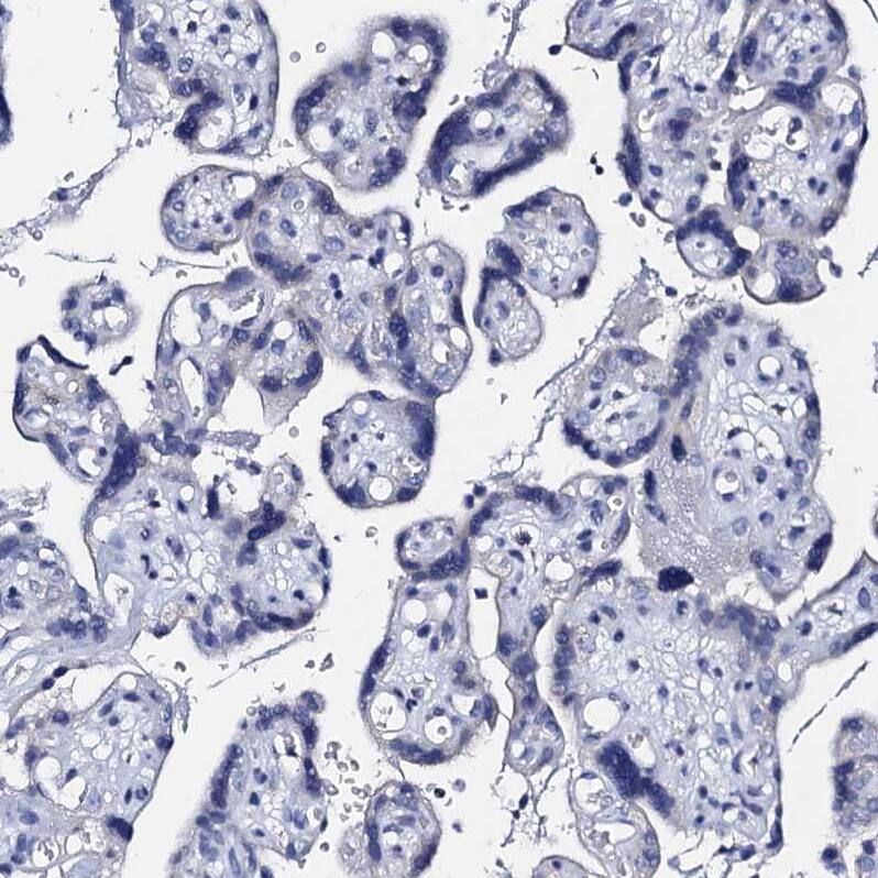 Staining of human placenta shows no positivity in trophoblastic cells as expected.