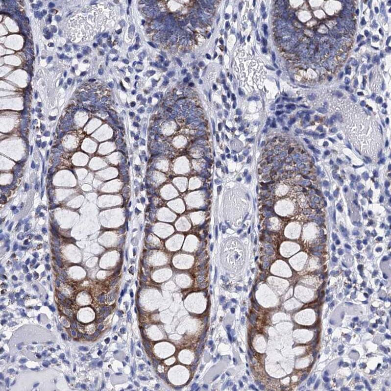 Staining of human colon shows strong cytoplasmic granular positivity in glandular cells.