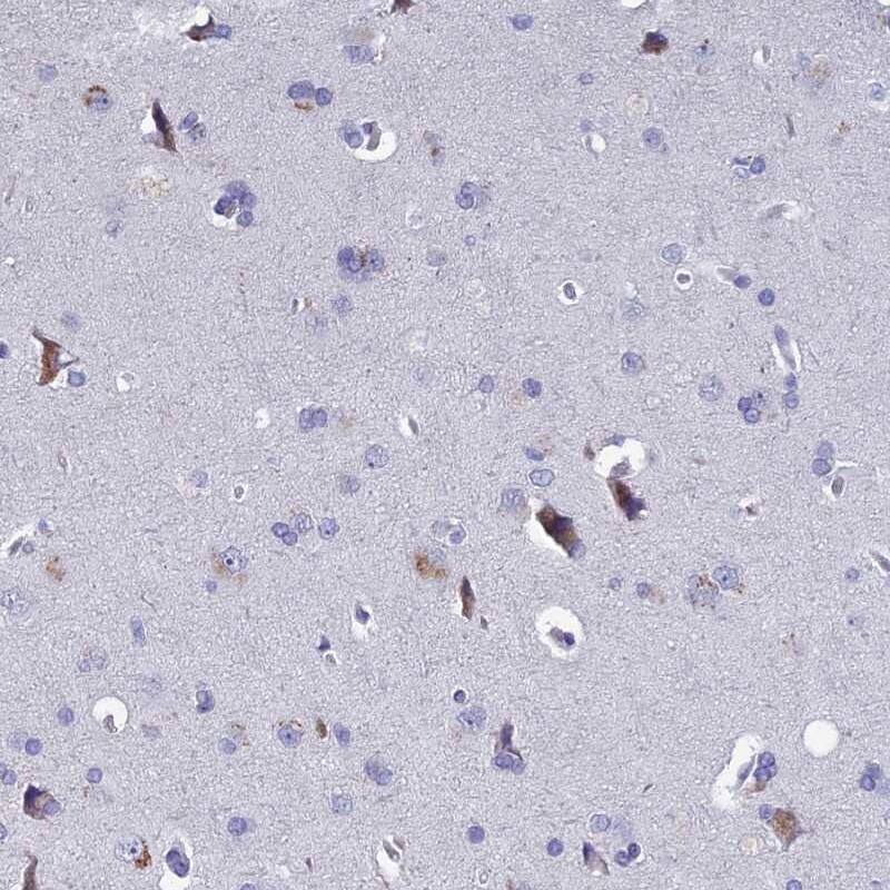Staining of human cerebral cortex shows high expression.