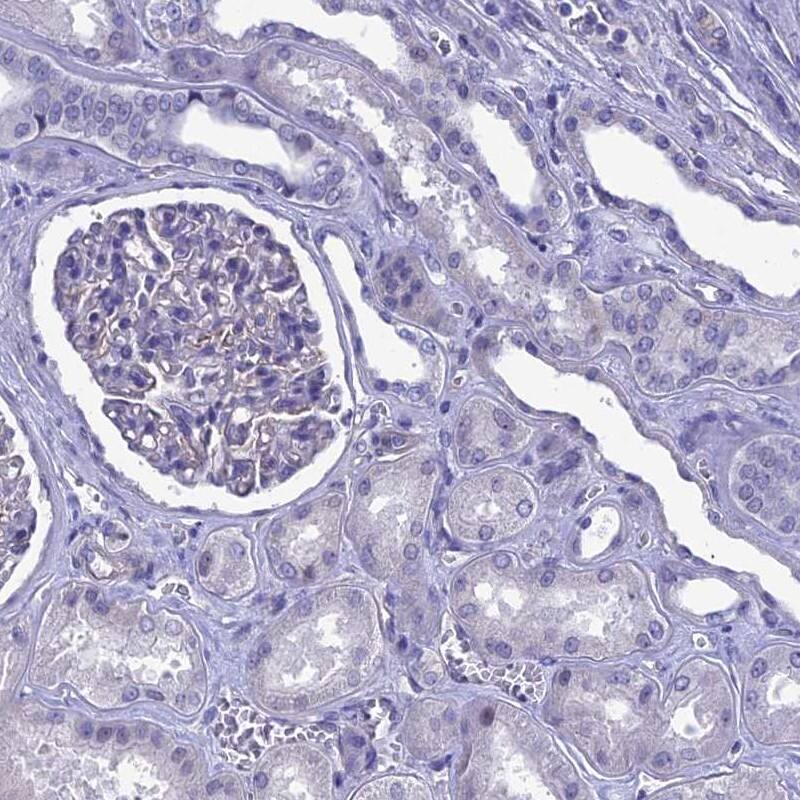 Staining of human kidney shows low expression as expected.