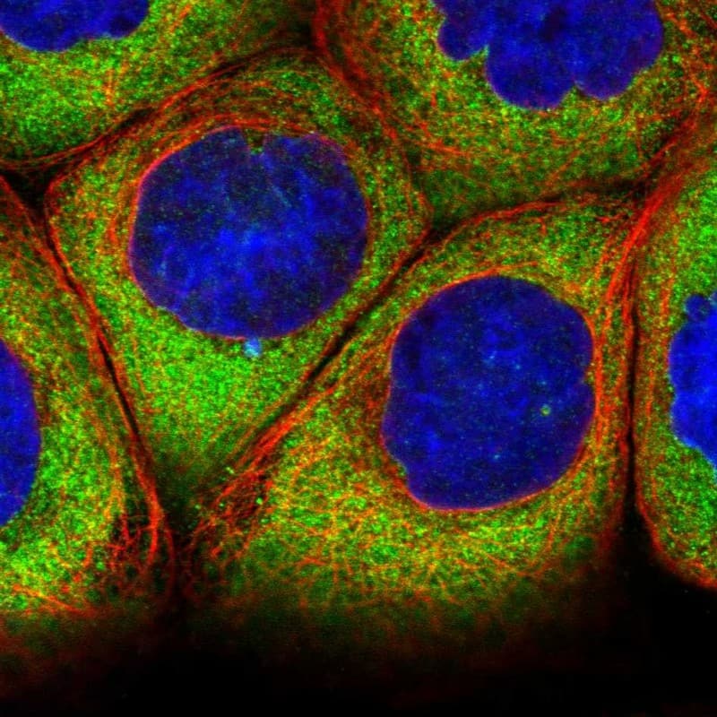 Staining of human cell line A-431 shows localization to cytosol.