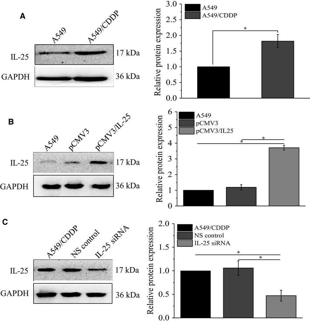 Western Blot: CCDC124 Antibody [NBP2-48858] - The expression of IL‐25 affects the cisplatin resistance of lung cancer cells. A, The expression of IL‐25 in A549 & A549/CDDP cells. B, IL‐25 overexpressed in A549 cells. C, silence of IL‐25 expression by siRNA in A549/CDDP cells. D, IL‐25 overexpression desensitizes A549 cells to cisplatin treatment. E, Silence of IL‐25 expression sensitizes A549/CDDP cells to cisplatin treatment. *P < 0.01 vs indicated controls, all figures represent the average of three sets of independent experiments Image collected & cropped by CiteAb from the following publication (//pubmed.ncbi.nlm.nih.gov/31044552), licensed under a CC-BY license. Not internally tested by Novus Biologicals.