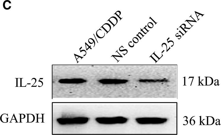 Western Blot: CCDC124 Antibody [NBP2-48858] - The expression of IL‐25 affects the cisplatin resistance of lung cancer cells. A, The expression of IL‐25 in A549 & A549/CDDP cells. B, IL‐25 overexpressed in A549 cells. C, silence of IL‐25 expression by siRNA in A549/CDDP cells. D, IL‐25 overexpression desensitizes A549 cells to cisplatin treatment. E, Silence of IL‐25 expression sensitizes A549/CDDP cells to cisplatin treatment. *P < 0.01 vs indicated controls, all figures represent the average of three sets of independent experiments Image collected & cropped by CiteAb from the following publication (//pubmed.ncbi.nlm.nih.gov/31044552), licensed under a CC-BY license. Not internally tested by Novus Biologicals.