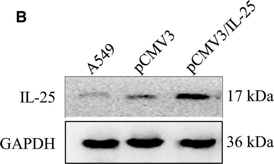 Western Blot: CCDC124 Antibody [NBP2-48858] - The expression of IL‐25 affects the cisplatin resistance of lung cancer cells. A, The expression of IL‐25 in A549 & A549/CDDP cells. B, IL‐25 overexpressed in A549 cells. C, silence of IL‐25 expression by siRNA in A549/CDDP cells. D, IL‐25 overexpression desensitizes A549 cells to cisplatin treatment. E, Silence of IL‐25 expression sensitizes A549/CDDP cells to cisplatin treatment. *P < 0.01 vs indicated controls, all figures represent the average of three sets of independent experiments Image collected & cropped by CiteAb from the following publication (//pubmed.ncbi.nlm.nih.gov/31044552), licensed under a CC-BY license. Not internally tested by Novus Biologicals.