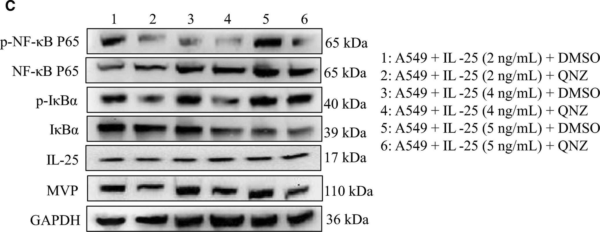 Western Blot: CCDC124 Antibody [NBP2-48858] - IL‐25 regulates the NF‐ kappa B signaling pathway activity. A, The change of NF‐ kappa B signaling pathway in IL‐25 overexpressed A549 cells & IL‐25 silenced A549/CDDP cells. B, The effect of exogenous IL‐25 on the activity of NF‐ kappa B signaling pathway in A549 cells. C, QNZ blocks the effect of exogenous IL‐25 on the expression of major vault protein (MVP) & the activity of NF‐ kappa B signaling pathway in A549 cells. *P < 0.01 vs indicated controls, all figures represent the average of three sets of independent experiments Image collected & cropped by CiteAb from the following publication (//pubmed.ncbi.nlm.nih.gov/31044552), licensed under a CC-BY license. Not internally tested by Novus Biologicals.