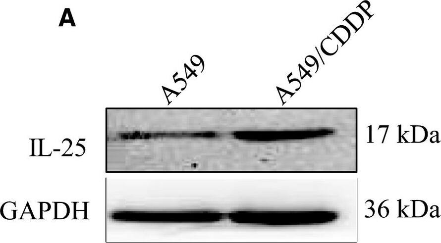Western Blot: CCDC124 Antibody [NBP2-48858] - The expression of IL‐25 affects the cisplatin resistance of lung cancer cells. A, The expression of IL‐25 in A549 & A549/CDDP cells. B, IL‐25 overexpressed in A549 cells. C, silence of IL‐25 expression by siRNA in A549/CDDP cells. D, IL‐25 overexpression desensitizes A549 cells to cisplatin treatment. E, Silence of IL‐25 expression sensitizes A549/CDDP cells to cisplatin treatment. *P < 0.01 vs indicated controls, all figures represent the average of three sets of independent experiments Image collected & cropped by CiteAb from the following publication (//pubmed.ncbi.nlm.nih.gov/31044552), licensed under a CC-BY license. Not internally tested by Novus Biologicals.