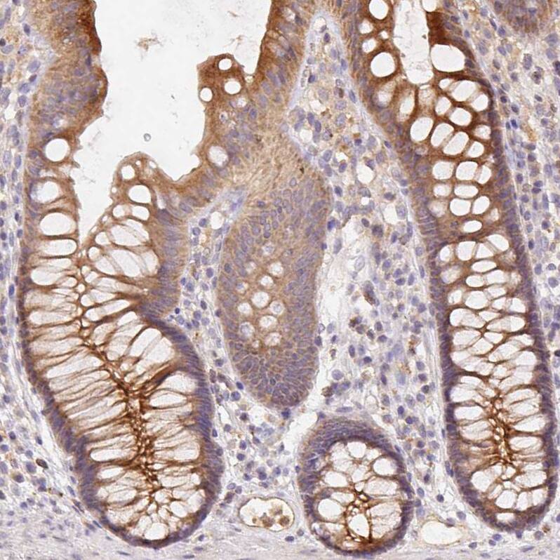 Immunohistochemistry-Paraffin Rab11A Antibody - BSA Free