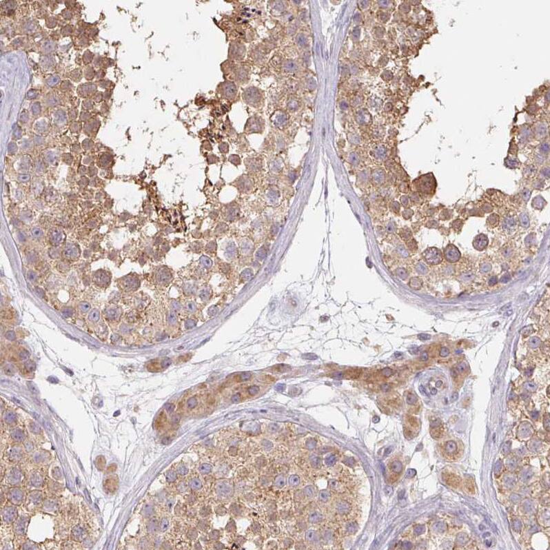 Staining of human testis shows weak to moderate cytoplasmic positivity in cells in seminiferous ducts.