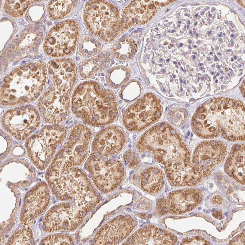 Immunohistochemistry-Paraffin Rab11A Antibody - BSA Free