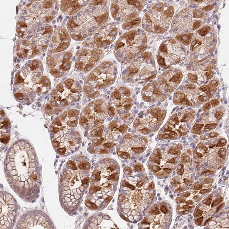 Immunohistochemistry-Paraffin Rab11A Antibody - BSA Free