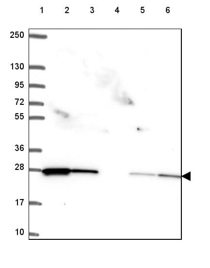 Lane 1: Marker [kDa] 250, 130, 95, 72, 55, 36, 28, 17, 10Lane 2: Human cell line RT-4Lane 3: Human cell line U-251 MGLane 4: Human plasmaLane 5: Human Liver tissueLane 6: Human Tonsil tissue