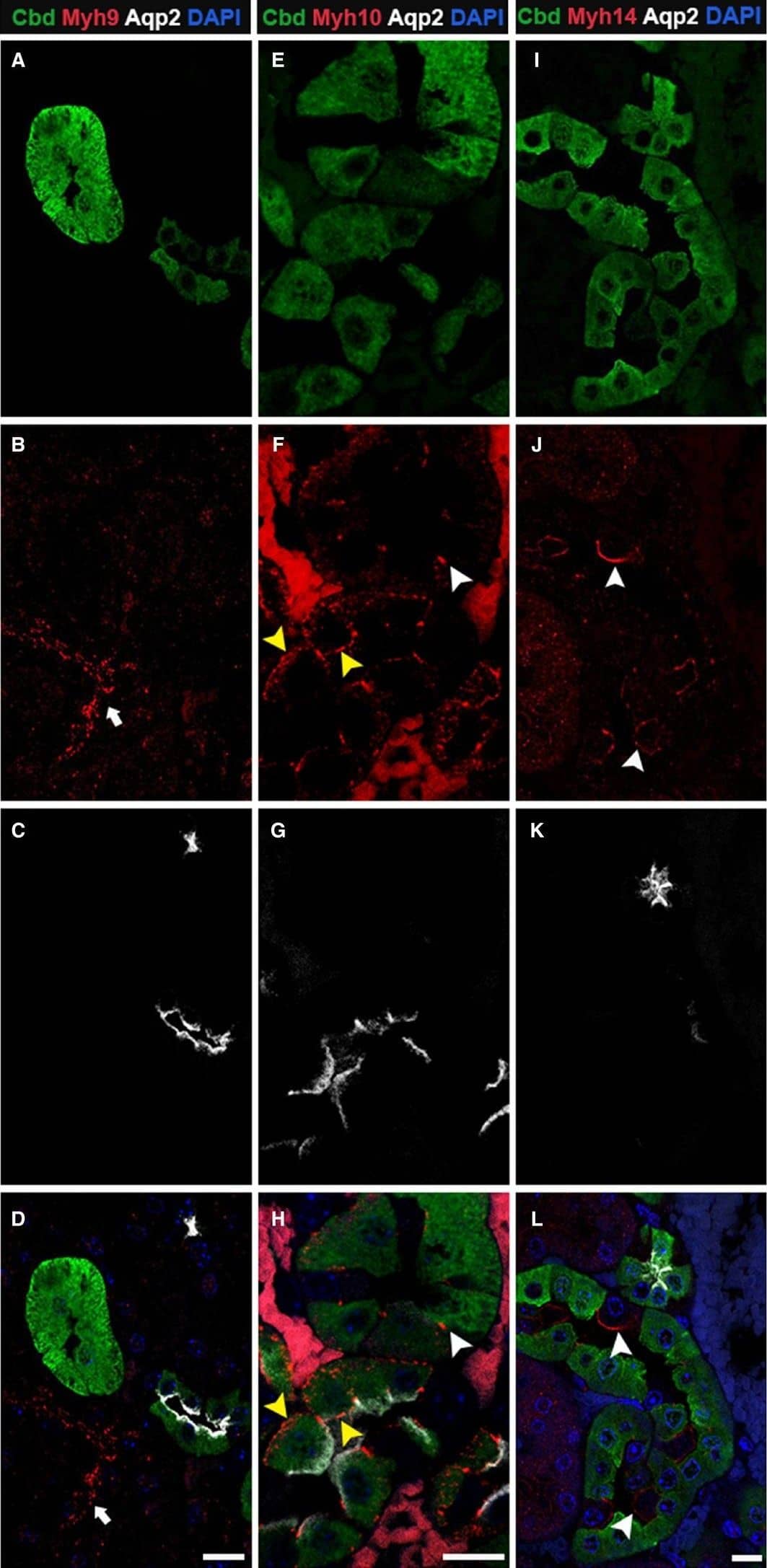 Immunocytochemistry/ Immunofluorescence: Calbindin D-28K Antibody [NBP2-50028] - Myh10 & Myh14 are the NM2 isoforms expressed in the distal & connecting renal tubules. Adult kidney sections were stained for calbindin‐D28K, Aqp2 & one of the NM2 isoforms. Myh9 (A–D) was not expressed in tubules positive for calbindin‐D28K & Aqp2; although adjacent tubules were positive for Myh9 (arrow). Myh10 (E–H) was expressed at low levels at the cell–cell junctions in calbindin‐D28K only positive tubules (white arrowhead), & in tubules positive for both calbindin‐D28K & Aqp2, Myh10 localized to cell–cell junctions, apical, & basolateral membrane (F & H, yellow arrowhead). Myh14 (I–L) was expressed on the apical membrane of calbindin‐D28K & Aqp2 null cells (arrowheads) in the distal tubular segments. Sections were mounted with vectashield containing DAPI to stain the nucleus (blue; D, H, & L). Scale bar = 10 μm. Image collected & cropped by CiteAb from the following publication (//pubmed.ncbi.nlm.nih.gov/29208685), licensed under a CC-BY license. Not internally tested by Novus Biologicals.