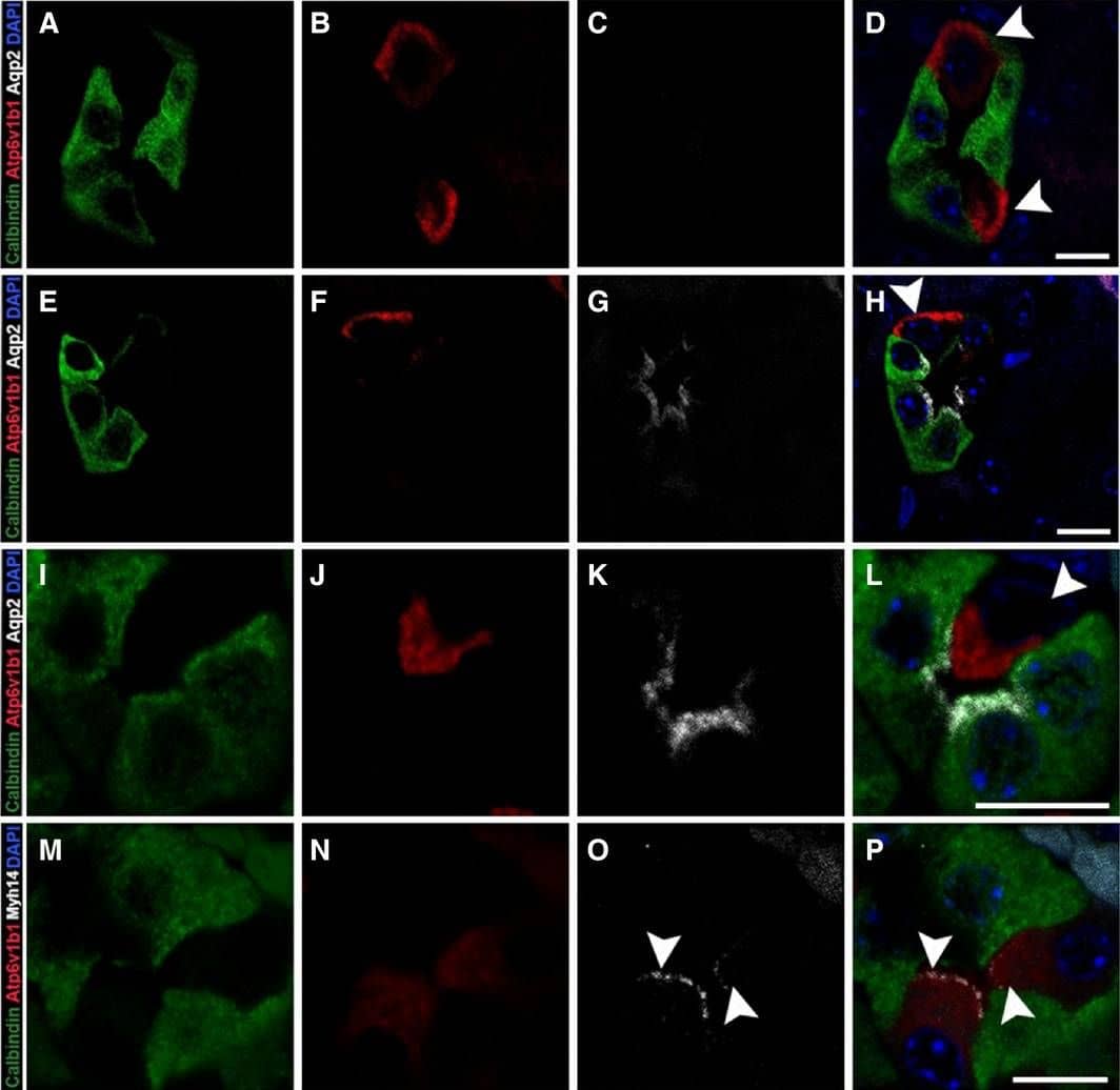 Immunocytochemistry/ Immunofluorescence: Calbindin D-28K Antibody [NBP2-50028] - Myh14 localizes to apical membranes of Atp6v1b1‐positive intercalated cells in the distal tubule. Adult kidney sections were stained for calbindin‐D28K, Atp6v1b1, Aqp2, & Myh14 to identify intercalated cells within the distal & connecting tubule segments as well as to confirm Myh14 localization to the intercalated cell type. Cells with positive staining for Atp6v1b1 (red) can be found in tubule segments positive for calbindin‐D28K only (A–D) as well as in tubules positive for both calbindin‐D28K & Aqp2 (E–H); in both cases Atp6v1b1 staining is observed along the basolateral membrane indicating  beta ‐ intercalated cell type (arrowhead, D&H). We also observed Atp6v1b1 staining in majority of the tubules along the apical membrane indicating the  alpha ‐ intercalated cell type (arrowhead, I–L). Myh14 localized to the apical membrane of the intercalated cell type in the distal tubule (arrowhead, M–P). Sections were mounted with vectashield containing DAPI to stain the nucleus (blue; D, H, L & P). Scale bar = 10 μm. Image collected & cropped by CiteAb from the following publication (//pubmed.ncbi.nlm.nih.gov/29208685), licensed under a CC-BY license. Not internally tested by Novus Biologicals.