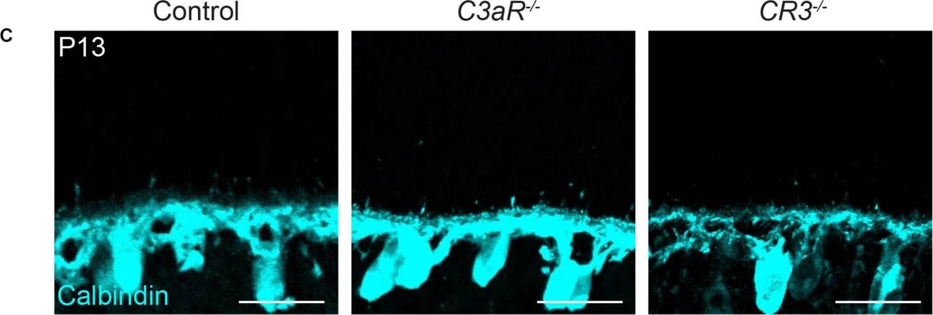 Immunohistochemistry: Calbindin D-28K Antibody [NBP2-50028] - Horizontal cells develop normally with the loss of either C3aR or CR3. (A,B) qRT-PCR for complement proteins C3aR & CR3 at P6, P13, & adult in wild type mice. Values represent the fold mRNA expression level relative to the levels detected in control animals following normalization to GAPDH. N = 3 animals. Representative images of horizontal cells (C, anti-calbindin, cyan) & quantifications (D,E) of ectopic horizontal cell neurites in control & C3aR–/– or CR3–/– mice at P13. Horizontal cell neurites in C3aR–/– & CR3–/– mice remain confined to the OPL, showing no increase in the number (D) or length (E) of ectopic neurites (n = 52 sprouts from four control mice; n = 84 sprouts from four C3aR–/– mice; n = 67 sprouts from four CR3–/– mice). Scale bars = 25 μm. Data are represented as the mean ± SEM (D) or as beeswarm SuperPlots (E) in which individual horizontal cell sprout values are presented together with the mean from each animal ± the SEM. Image collected & cropped by CiteAb from the following publication (//pubmed.ncbi.nlm.nih.gov/33177995), licensed under a CC-BY license. Not internally tested by Novus Biologicals.