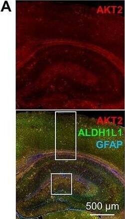 AKT2 is expressed in astroglia. (A) Representative image of AKT2 (red) costaining with astrocyte markers ALDH1L1 (green) and glial fibrillary acidic protein (GFAP, blue) in the HPC and CTX of coronal mouse brain sections. AKT2 is present throughout these brain regions, with strong immunoreactivity in the molecular layer of the DG. (B) Higher magnification of the rectangular area in (A) shows ALDH1L1 expression throughout cortical layers I-VI like AKT2, whereas GFAP is largely absent from the CTX and displays greater immunoreactivity in the HPC. (C) Higher magnification of the white square in (B) confirms that AKT2 colocalizes with ALDH1L1, while little to no GFAP is detected in the CTX. (D) In the DG corresponding to the white square area in (A), AKT2 colocalizes with both ALDH1L1 and GFAP and is absent from the neuronal cell bodies in the granule cell layer. Lower panels: Higher magnification of the white square with profile views of the Z-stack images through an AKT2+ cell (arrow) confirms that AKT2 is present in the cell bodies of ALDH1L1+ and GFAP+ astrocytes. Image collected and cropped by CiteAb from the following open publication (//pubmed.ncbi.nlm.nih.gov/34296180), licensed under a CC-BY license. Not internally tested by Novus Biologicals.