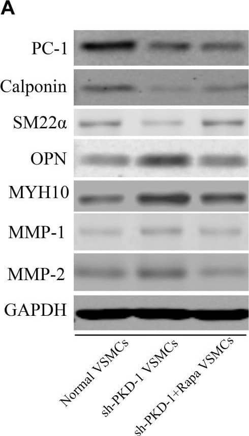 The effects of downregulation and overexpression of PKD-1 on the phenotypes of aortic VSMCs (n = 6 for each group). (A) PKD-1 knockdown inhibited the expression of (A,B1) PC-1 (p < 0.0001, p < 0.0001), (A,B2) calponin (p = 0.0001, p = 0.0008) and (A,B3) SM22 alpha  (p = 0.0053, p = 0.0194) as well as elevated the expression of (A,B4) OPN (p < 0.0001, p = 0.0037), (A,B5) MYH10 (p < 0.0001, p = 0.0001), (A,B7) MMP-2 (p < 0.0001, p = 0.0003) Rapamycin didn’t affect the expression of (A,B1) PC-1 (p < 0.0001, p < 0.0001) in sh-PKD-1 VSMCs but elevated the expression of (A,B2) calciponin (p = 0.0026, p = 0.0038) and (A,B3) SM22 alpha  (p = 0.0352, p = 0.034) and downregulated the expression of (A,B4) OPN (p = 0.0009, p = 0.0101), (A,B5) MYH10 (p = 0.0002, p = 0.0105), (A,B7) MMP2 (p < 0.0001, p = 0.0031). (A,B6) Showed the protein expression of MMP-1 among three groups. Treatment of sg-PKD-1 enhanced the expression of (C,D1) PC-1 (p < 0.0001, p < 0.0001), (C,D2) calciponin (p = 0.0054, p = 0.0004) and (C,D3) SM22 alpha  (p = 0.0005, p = 0.0003), but inhibited the expression of (C,D4) OPN (p = 0.0125, p = 0.0002), (C,D5) MYH10 (p = 0.0078, p = 0.0002), (C,D7) MMP2 (p < 0.0001, p = 0.0009). (C,D6) Showed the protein expression of MMP-1between normal and sg-PKD-1 VSMCs. *p < 0.05, **p < 0.01, ***p < 0.001, ****p < 0.0001 (compared with normal VSMCs); ##p < 0.01, ###p < 0.001 (compared with TAD VSMCs). #Means the comparison between sh-PKD1 and sh-PKD1 + Rapa VSMCs. p < 0.05. Image collected and cropped by CiteAb from the following open publication (//pubmed.ncbi.nlm.nih.gov/33071810), licensed under a CC-BY license. Not internally tested by Novus Biologicals.