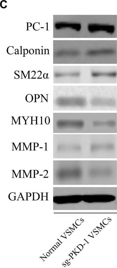 The effects of downregulation and overexpression of PKD-1 on the phenotypes of aortic VSMCs (n = 6 for each group). (A) PKD-1 knockdown inhibited the expression of (A,B1) PC-1 (p < 0.0001, p < 0.0001), (A,B2) calponin (p = 0.0001, p = 0.0008) and (A,B3) SM22 alpha  (p = 0.0053, p = 0.0194) as well as elevated the expression of (A,B4) OPN (p < 0.0001, p = 0.0037), (A,B5) MYH10 (p < 0.0001, p = 0.0001), (A,B7) MMP-2 (p < 0.0001, p = 0.0003) Rapamycin didn’t affect the expression of (A,B1) PC-1 (p < 0.0001, p < 0.0001) in sh-PKD-1 VSMCs but elevated the expression of (A,B2) calciponin (p = 0.0026, p = 0.0038) and (A,B3) SM22 alpha  (p = 0.0352, p = 0.034) and downregulated the expression of (A,B4) OPN (p = 0.0009, p = 0.0101), (A,B5) MYH10 (p = 0.0002, p = 0.0105), (A,B7) MMP2 (p < 0.0001, p = 0.0031). (A,B6) Showed the protein expression of MMP-1 among three groups. Treatment of sg-PKD-1 enhanced the expression of (C,D1) PC-1 (p < 0.0001, p < 0.0001), (C,D2) calciponin (p = 0.0054, p = 0.0004) and (C,D3) SM22 alpha  (p = 0.0005, p = 0.0003), but inhibited the expression of (C,D4) OPN (p = 0.0125, p = 0.0002), (C,D5) MYH10 (p = 0.0078, p = 0.0002), (C,D7) MMP2 (p < 0.0001, p = 0.0009). (C,D6) Showed the protein expression of MMP-1between normal and sg-PKD-1 VSMCs. *p < 0.05, **p < 0.01, ***p < 0.001, ****p < 0.0001 (compared with normal VSMCs); ##p < 0.01, ###p < 0.001 (compared with TAD VSMCs). #Means the comparison between sh-PKD1 and sh-PKD1 + Rapa VSMCs. p < 0.05. Image collected and cropped by CiteAb from the following open publication (//pubmed.ncbi.nlm.nih.gov/33071810), licensed under a CC-BY license. Not internally tested by Novus Biologicals.