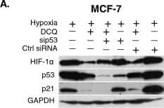 Western Blot: p53 Antibody (Pab DO-1) - BSA Free [NBP2-50538] - DCQ reduces HIF-1 alpha  through different mechanisms in MCF-7 & MDA-MB-231. (A) MCF-7 cells were transfected with siRNA against p53 & ctrl siRNA (scrambled sequence) using lipofectamine 2000. After 24 hours, cells were treated with DCQ (5 μM) for 6 hours under hypoxia. Whole cell lysates were prepared, & blots were probed against indicated antibodies. (B) MCF-7 cells were transfected with siRNA against p53 & ctrl siRNA (scrambled sequence) using lipofectamine 2000. Transfected cells were treated with DCQ (5 μM) for 6 hours under hypoxia. The extent of DNA fragmentation was determined by TUNEL assay 24 hours later using flow cytometry. One-way ANOVA was used to compare DCQ-treated versus control & statistical significance of p < 0.05 is indicated by *. (C) Whole cell lysates were prepared after pretreating MCF-7 & MDA-MB-231 with the proteasome inhibitor MG132 (3 μM) then treated with DCQ, & blots were probed for HIF-1 alpha . Results are from three independent experiments. (D) Whole cell lysates of MCF-7 were prepared after 6 hours of exposure to DCQ (5 μM) under normoxia or hypoxia, & blots were probed for p-AKT, mTOR, p-mTOR & GAPDH. Image collected & cropped by CiteAb from the following publication (//molecular-cancer.biomedcentral.com/articles/10.1186/1476-4598-13-12), licensed under a CC-BY license. Not internally tested by Novus Biologicals.