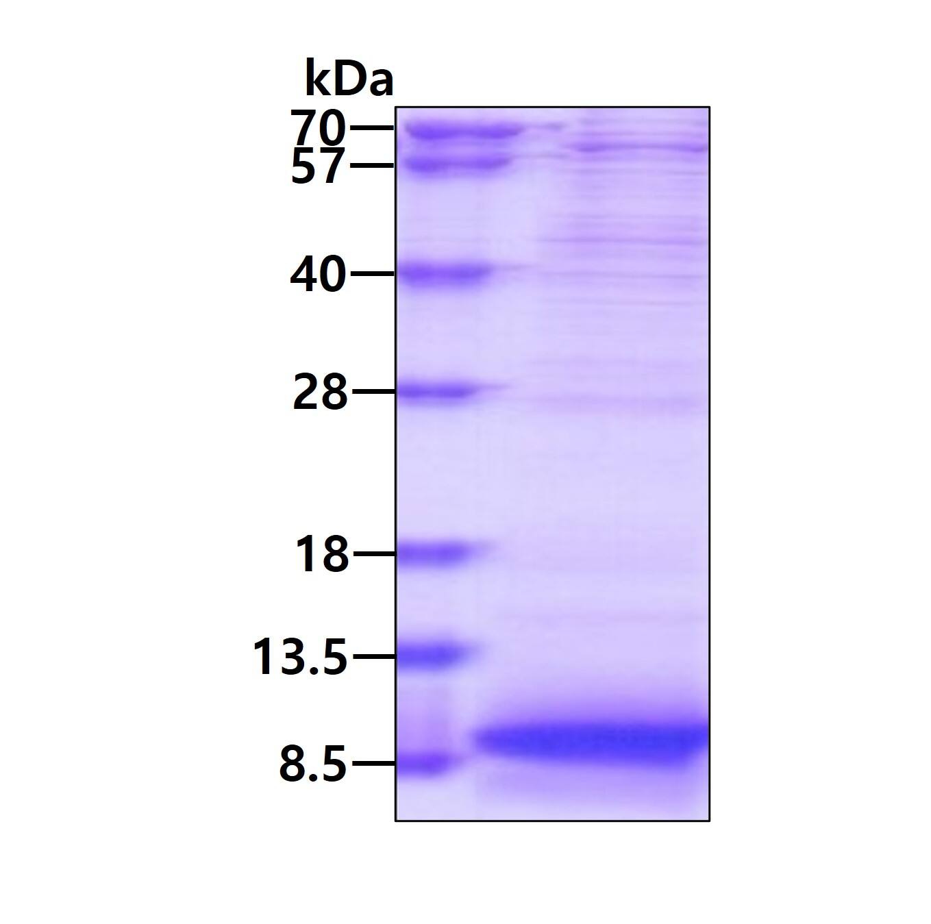 SDS-PAGE Recombinant Human Apolipoprotein C1 His Protein