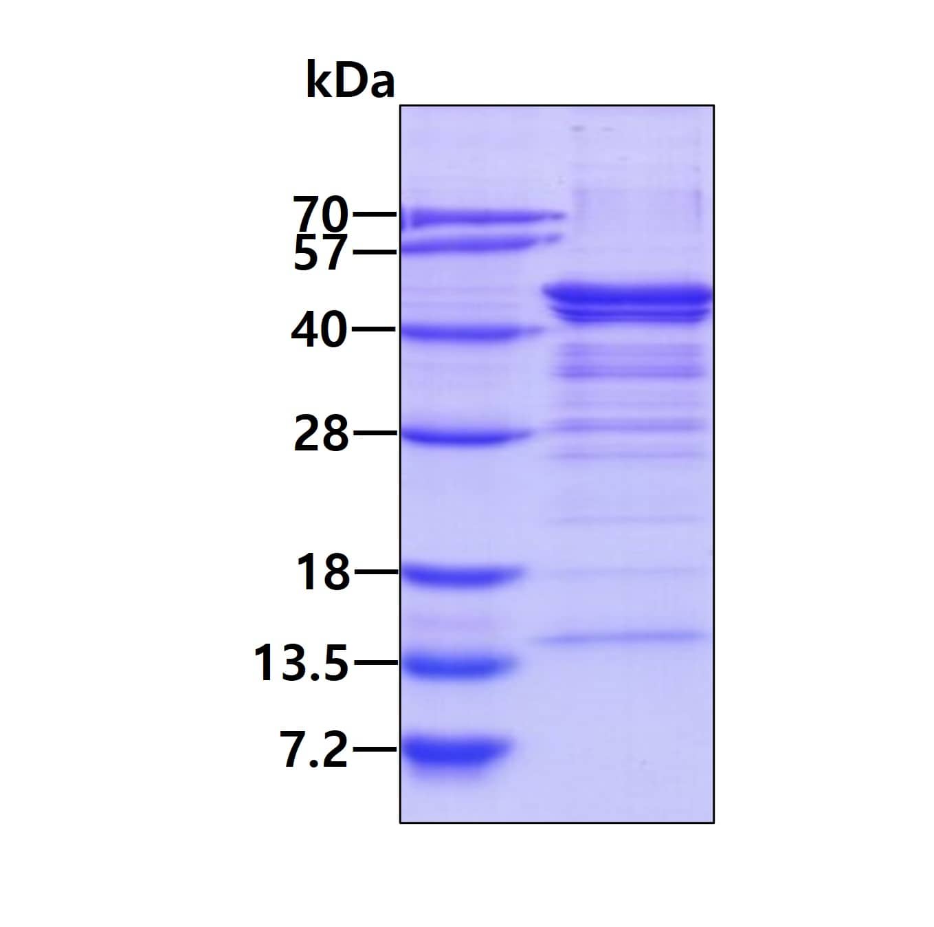 3ug by SDS-PAGE under reducing condition and visualized by coomassie blue stain.