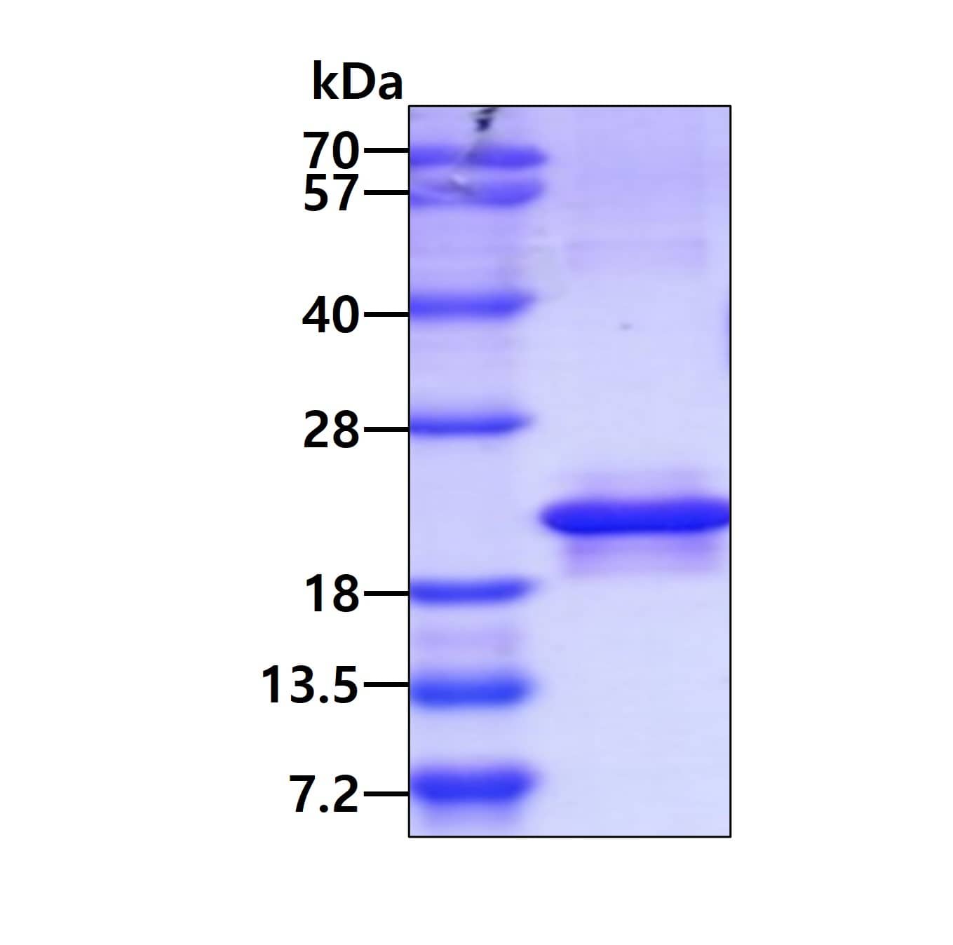 SDS-Page: MOSPD1 Recombinant Protein [NBP2-51869] - 3ug by SDS-PAGE under reducing condition and visualized by coomassie blue stain.