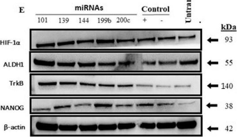 ZEB 1 suppression by miRNAs maintains cancer stem cell properties. mRNA expression levels of cancer stem cell-related genes (A–D). (A) Cells transfected with ZEB1 inhibitor miRNAs upregulate TrkB mRNA expression apart from miR-101-3p, miR-139-5p, and miR-144-3p (t-test *, p = 0.02, *, p = 0.01, and **, p = 0.004, respectively). (B) miR-200c-3p does not affect ALDH mRNA expression compared to the other miRNAs, which increase its expression (Mann–Whitney **, p101 = 0.009, t-test **, p139 = 0.009, t-test ** p144 = 0.002, and t-test ***, p199 = 0.0006). (C) NANOG mRNA is significantly upregulated after transfection with miR-144-3p and miR-199b-5p and shows no significant upregulation for the other miRNAs (t-test **, p = 0.002, and *, p = 0.02, respectively). (D) HIF-1 alpha  mRNA levels are upregulated after transfection with miR-144-3p but shows no statistical significance for the other microRNAs (t-test *, p = 0.03). (E) Western blot results of mRNA expression findings. Image collected and cropped by CiteAb from the following open publication (//www.mdpi.com/1422-0067/24/6/5916), licensed under a CC-BY license. Not internally tested by Novus Biologicals.