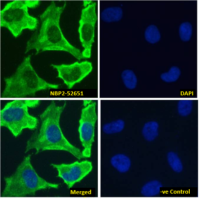 Immunocytochemistry /Immunofluorescence: EGFR Antibody (528) - Chimeric - Azide and BSA Free [NBP2-52651] - Immunofluorescence analysis of paraformaldehyde fixed HeLa cells, permeabilized with 0.15% Triton and stained with NBP2-52651 at 10ug/ml for 1h followed by Alexa Fluor 488 secondary antibody (1ug/ml), showing membrane staining. The nuclear stain is DAPI (blue). Panels show from left-right, top-bottom NBP2-52651, DAPI, merged channels and a negative control. The negative control was stained with unimmunized rabbit IgG followed by Alexa Fluor 488 secondary antibody.