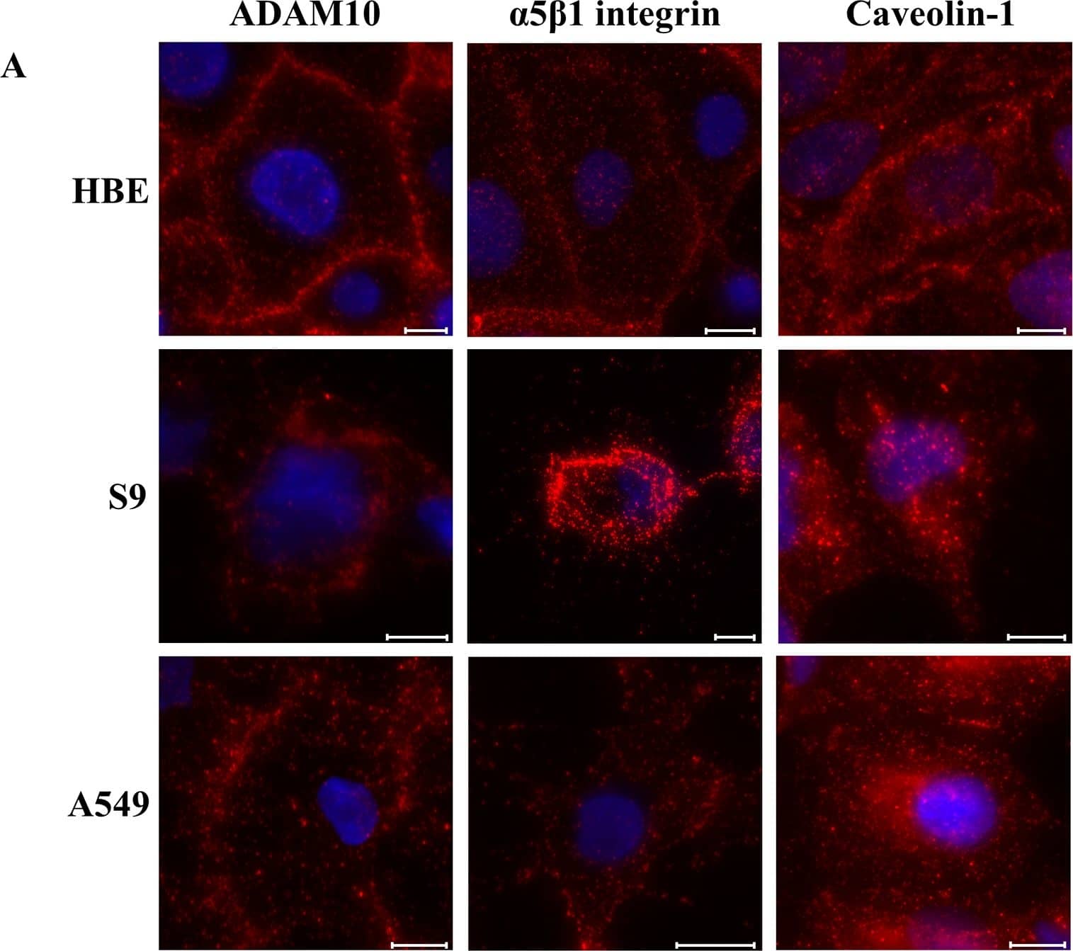 Abundance of two potential Hla receptors and of caveolin-1 as a potential pore-stabilizing factor.A: Representative examples of immune fluorescence assays using epifluorescence microscopy (nuclei counterstained using DAPI) that were performed on 16HBE14o-, S9 or A549 cells grown on coverslips using antibodies against ADAM10, the  alpha 5 beta 1 integrin or against caveolin-1. Staining appearing in red represents specific labelling of the respective proteins. Scale bars: 10 μm. B: Semi-quantitative determination of primary and secondary antibody-mediated fluorescence in suspended individual cells by flow cytometry. During flow cytometry, the fluorescence of the antibody-tagged proteins per cell was measured and the respective medians of the detected peaks were used for calculating the means +/- S.D. for the biological replicates (n = 4, each). Individual means were tested for significant differences using Student’s t-test or Welch’s t-test: * = p ≤ 0.05, ** = p ≤ 0.01 or *** = p ≤ 0.001. Image collected and cropped by CiteAb from the following open publication (//pubmed.ncbi.nlm.nih.gov/32470006), licensed under a CC-BY license. Not internally tested by Novus Biologicals.
