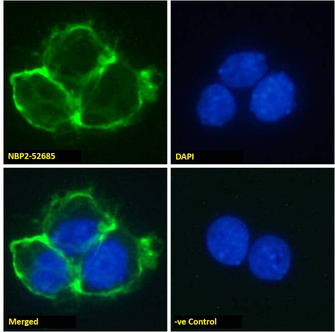 Immunocytochemistry /Immunofluorescence: EGFR Antibody (Matuzumab) - Chimeric - Azide and BSA Free [NBP2-52685] - Immunofluorescence staining of fixed A431 cells with anti-EGFR antibody Matuzumab. Immunofluorescence analysis of unpermeabilisd paraformaldehyde fixed A431 cells on Shi-fix coverslips stained with NBP2-52685 at 10 ug/ml for 1h followed by Alexa Fluor 488 secondary antibody (1 ug/ml), showing membrane staining. The nuclear stain is DAPI (blue). Panels show from left-right, top-bottom NBP2-52685, DAPI, merged channels and an isotype control. The isotype control was stained with unimmunised rabbit IgG followed by Alexa Fluor 488 secondary antibody.