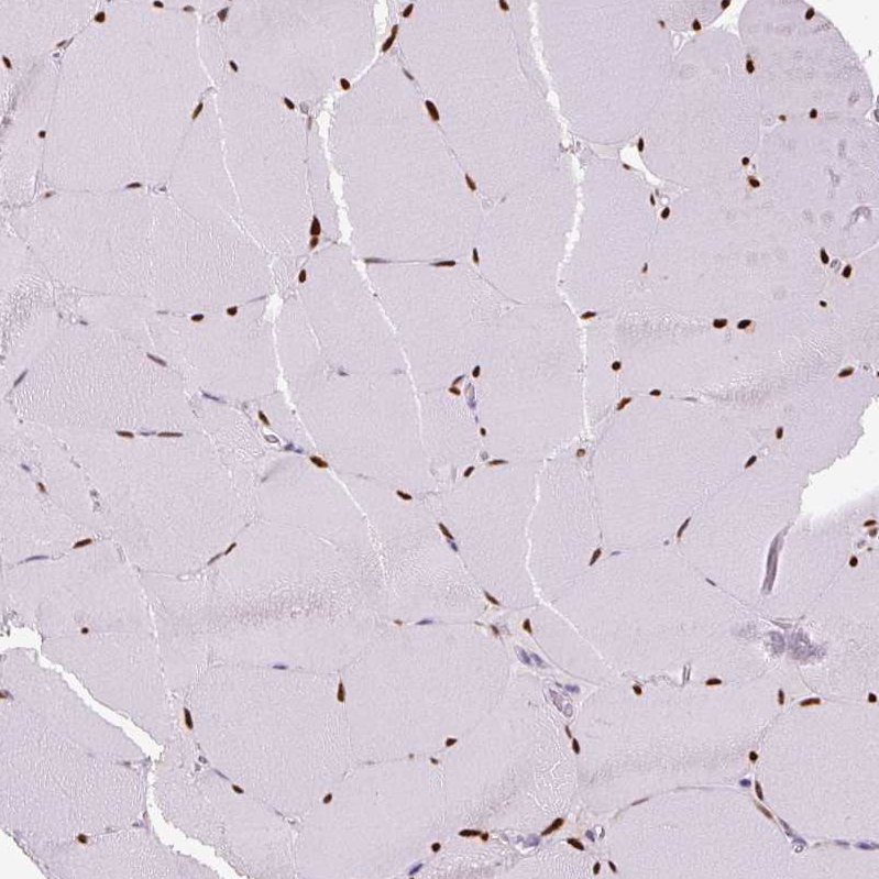 Immunohistochemistry-Paraffin SIX1 Antibody (CL0185) - BSA Free