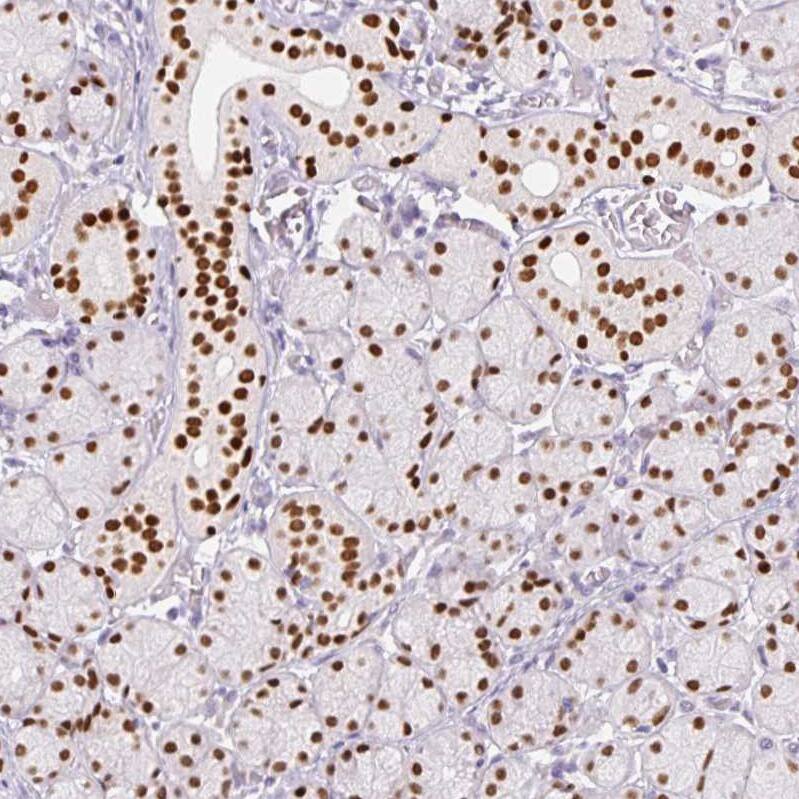 Immunohistochemistry-Paraffin SIX1 Antibody (CL0185) - BSA Free
