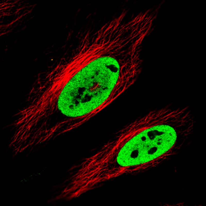 Staining in MCF7 cell line with Anti-FUS monoclonal antibody, showing clear nuclear (without nucleoli) staining in green. Microtubule- and nuclear probes are visualized in red and blue respectively (where available).