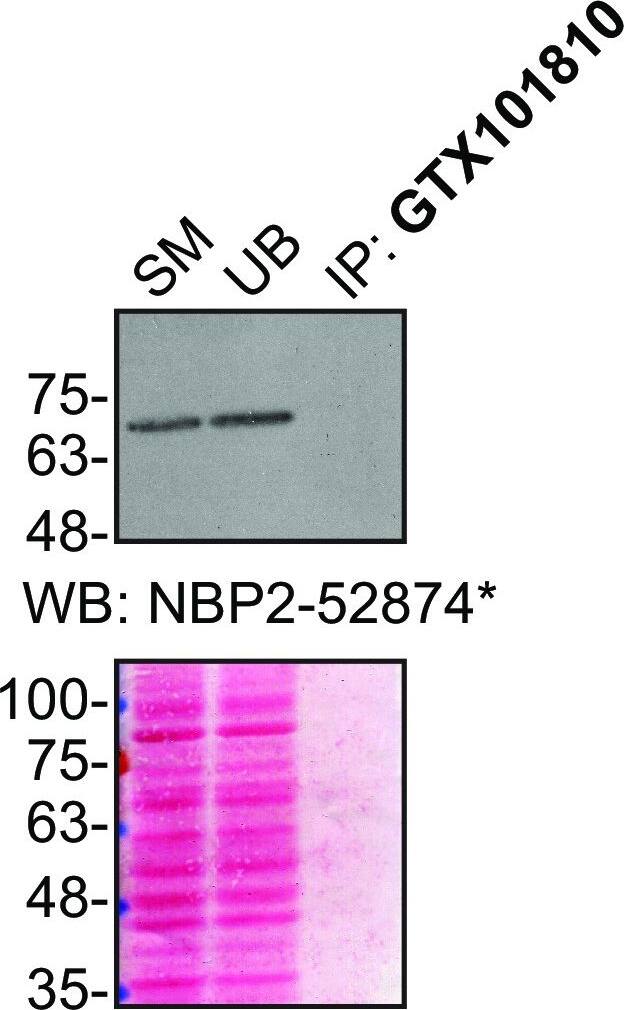 FUS antibody screening by immunoprecipitation.HeLa lysates were prepared, and IP was performed using 1.0 μg of the indicated FUS antibodies pre-coupled to protein G or protein A Sepharose beads. Samples were washed and processed for Western Blot with the indicated FUS antibody. For Western Blot, NBP2-52874* and ab243880** were used at a dilution of 1/2000. The Ponceau stained transfers of each blot are shown for similar reasons as inFigure 1. SM=10% starting material; UB=10% unbound fraction; IP=immunoprecipitated. *Monoclonal antibody; **Recombinant antibody. Image collected and cropped by CiteAb from the following open publication (//pubmed.ncbi.nlm.nih.gov/37384305), licensed under a CC-BY license. Not internally tested by Novus Biologicals.