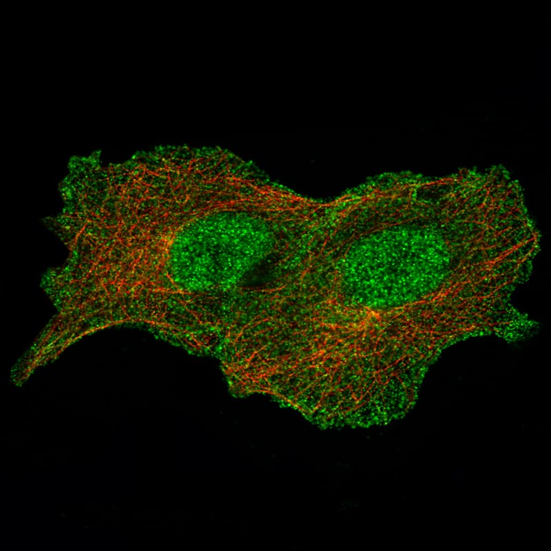 Staining of A549 cells, showing specific staining in the nucleus, cytosol and the plasma membrane in green. Microtubule- and nuclear probes are visualized in red and blue, respectively (where available).