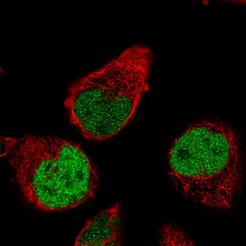 Staining of RH-30 cells, showing specific staining in the nucleoplasm in green. Microtubule- and nuclear probes are visualized in red and blue, respectively (where available).