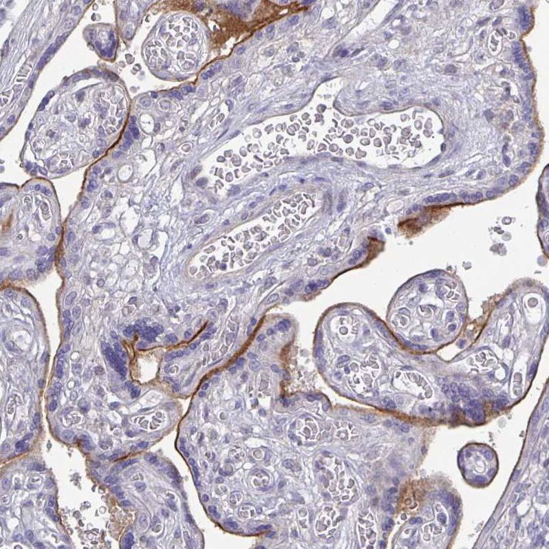 Staining of human placenta shows moderate membranous positivity in trophoblastic cells.
