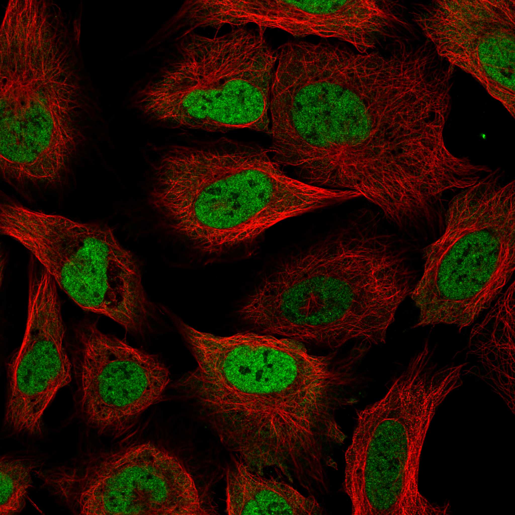 Staining of U-2 OS cells, showing specific staining in the nucleoplasm in green. Microtubule- and nuclear probes are visualized in red and blue, respectively (where available).
