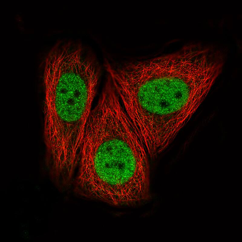 Staining of MCF7 cells, showing specific staining in the nucleoplasm in green. Microtubule- and nuclear probes are visualized in red and blue, respectively (where available).