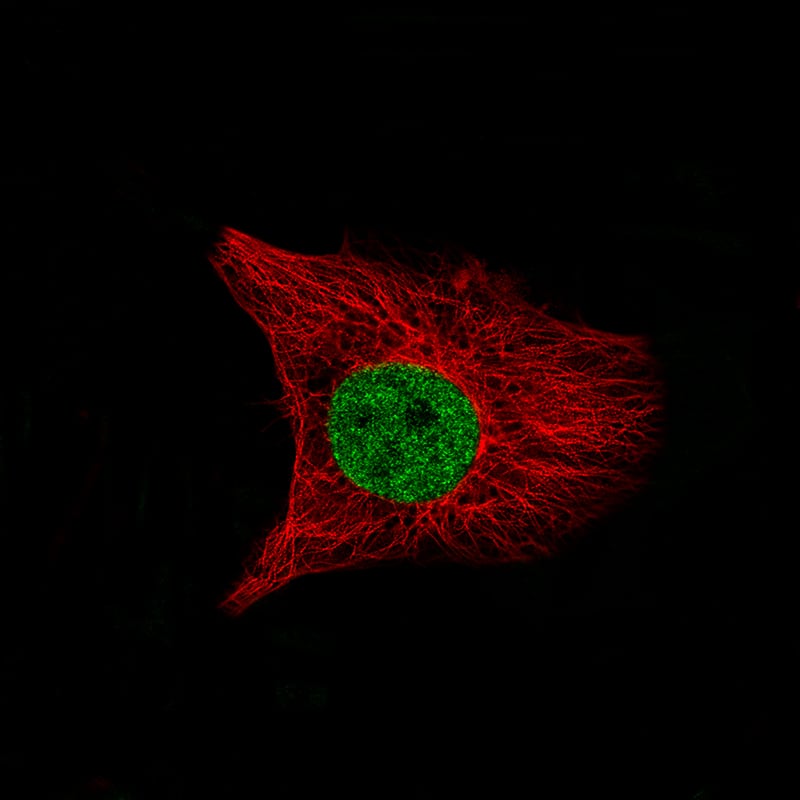 Staining of U-138 MG cells, showing specific staining in the nucleoplasm in green. Microtubule- and nuclear probes are visualized in red and blue, respectively (where available).
