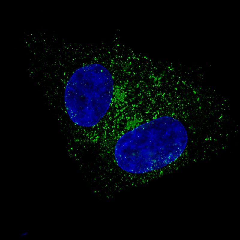 Staining of RT-4 cells using the Anti-FBLN1 monoclonal antibody, showing specific staining in vesicles in green. Microtubule- and nuclear probes are visualized in red and blue, respectively (where available).