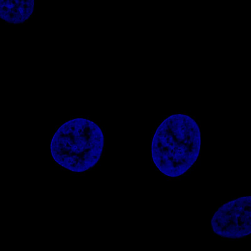 Staining of MCF7 cells using the Anti-FBLN1 monoclonal antibody, showing no specific staining of vesicles. MCF7 cells serves as a negative control based on RNA-seq values. Microtubule- and nuclear probes are visualized in red and blue, respectively (where available).