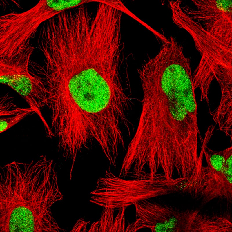 Staining of U-251 cells, showing specific staining in the nucleoplasm in green. Microtubule- and nuclear probes are visualized in red and blue, respectively (where available).