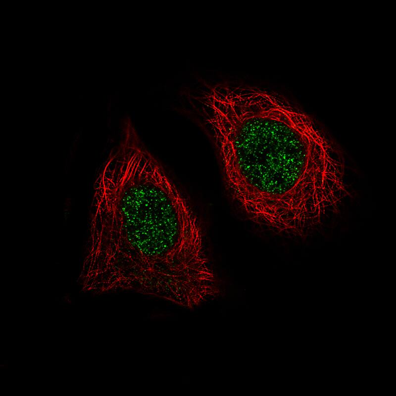 Staining of MCF-7 cells, showing specific staining in the nucleoplasm in green. Microtubule- and nuclear probes are visualized in red and blue, respectively (where available).