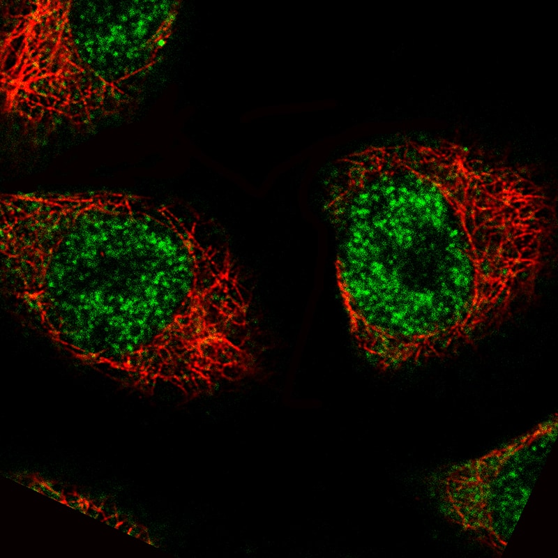 Staining of A549 cells, showing specific staining in nuclear speckles and the cytosol in green. Microtubule- and nuclear probes are visualized in red and blue, respectively (where available).