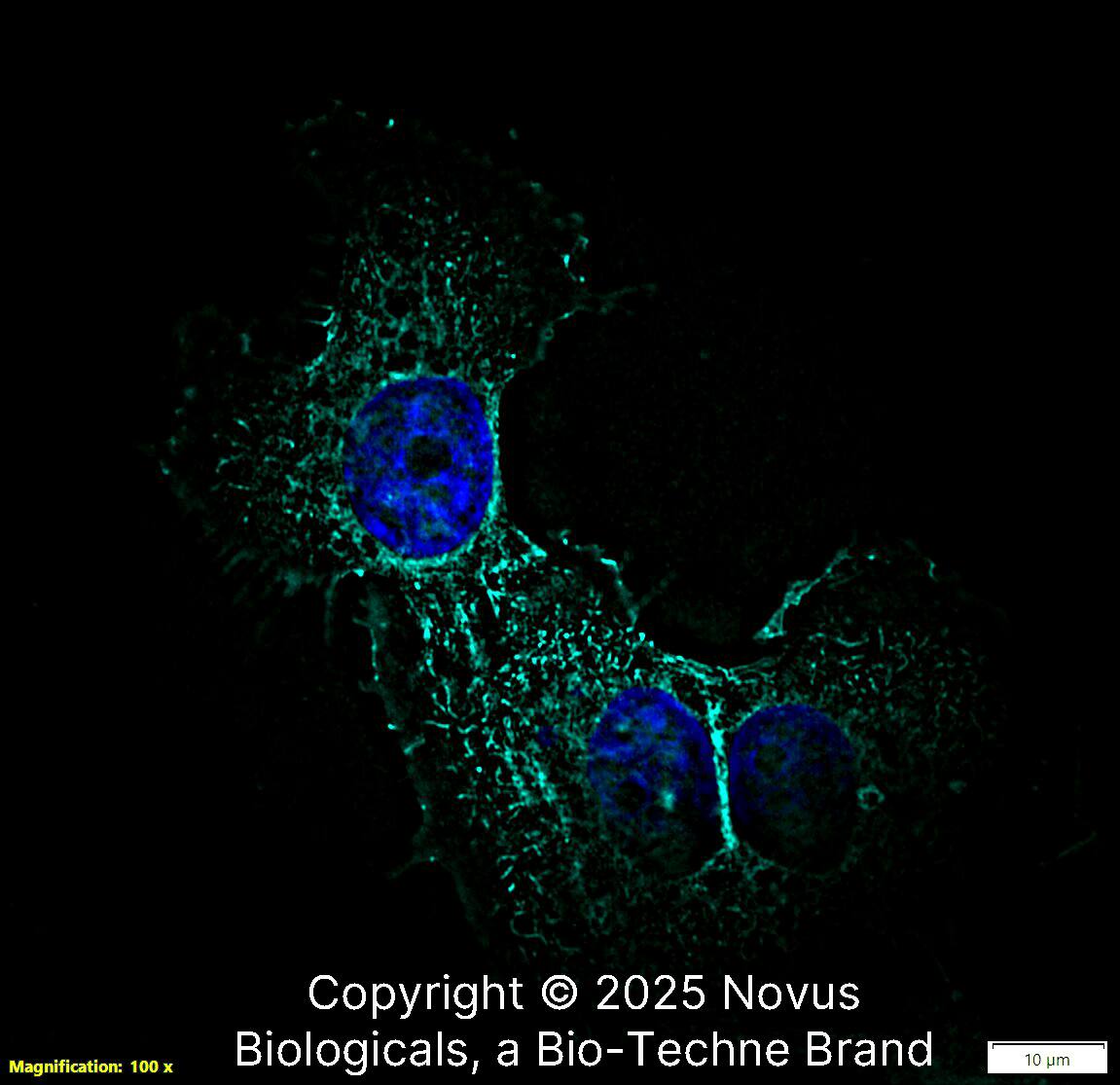 Ezrin was detected in immersion fixed A431 human skin carcinoma cell line using Rabbit anti-Ezrin Affinity Purified Polyclonal Antibody conjugated to Alexa Fluor® 647 (Catalog # NBP2-52977AF647) (light blue) at 5 µg/mL overnight at 4C. Cells were counterstained with DAPI (blue). Cells were imaged using a 100X objective and digitally deconvolved.
