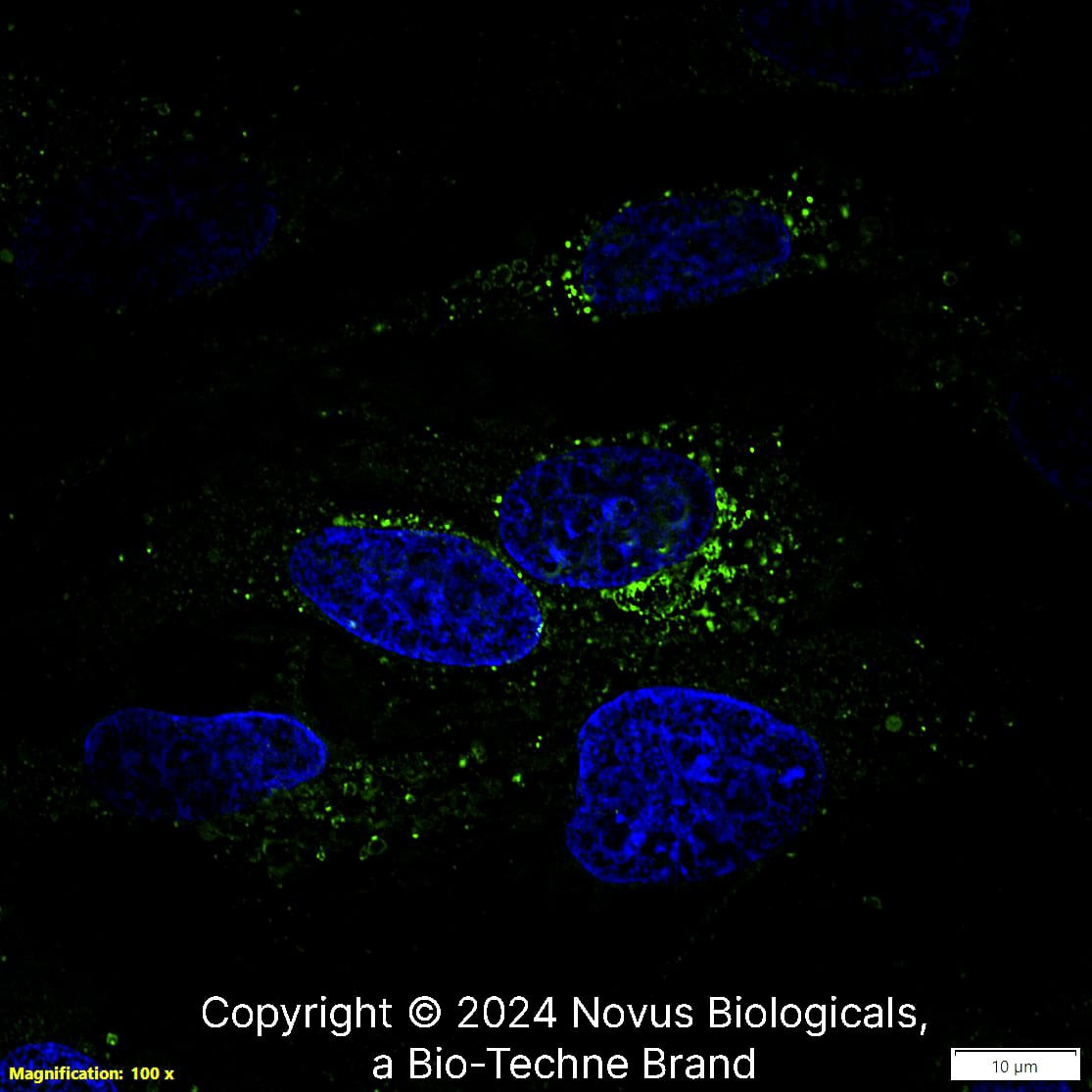 Apolipoprotein A-I/ApoA1 was detected in immersion fixed HepG2 human hepatocellular carcinoma cell line using Rabbit anti- Apolipoprotein A-I/ApoA1 Affinity Purified Polyclonal Antibody conjugated to Alexa Fluor® 488 (Catalog # NBP2-52979AF488) (green) at 10 µg/mL overnight at 4C. Cells were counterstained with DAPI (dark blue). Cells were imaged using a 100X objective and digitally deconvolved.